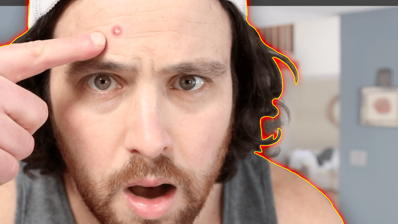 Intermittent Fasting Skin Benefits | Can it Clear Up Your SKIN?